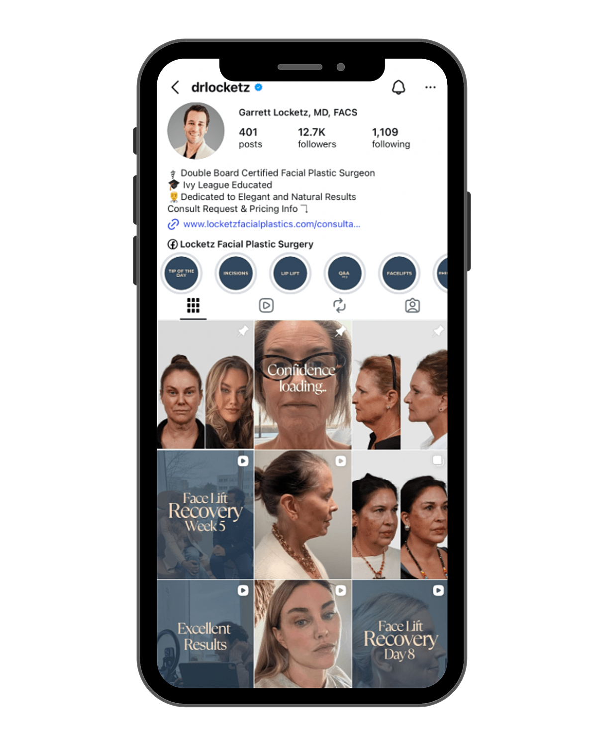 Facial plastic surgery Instagram profile overview.